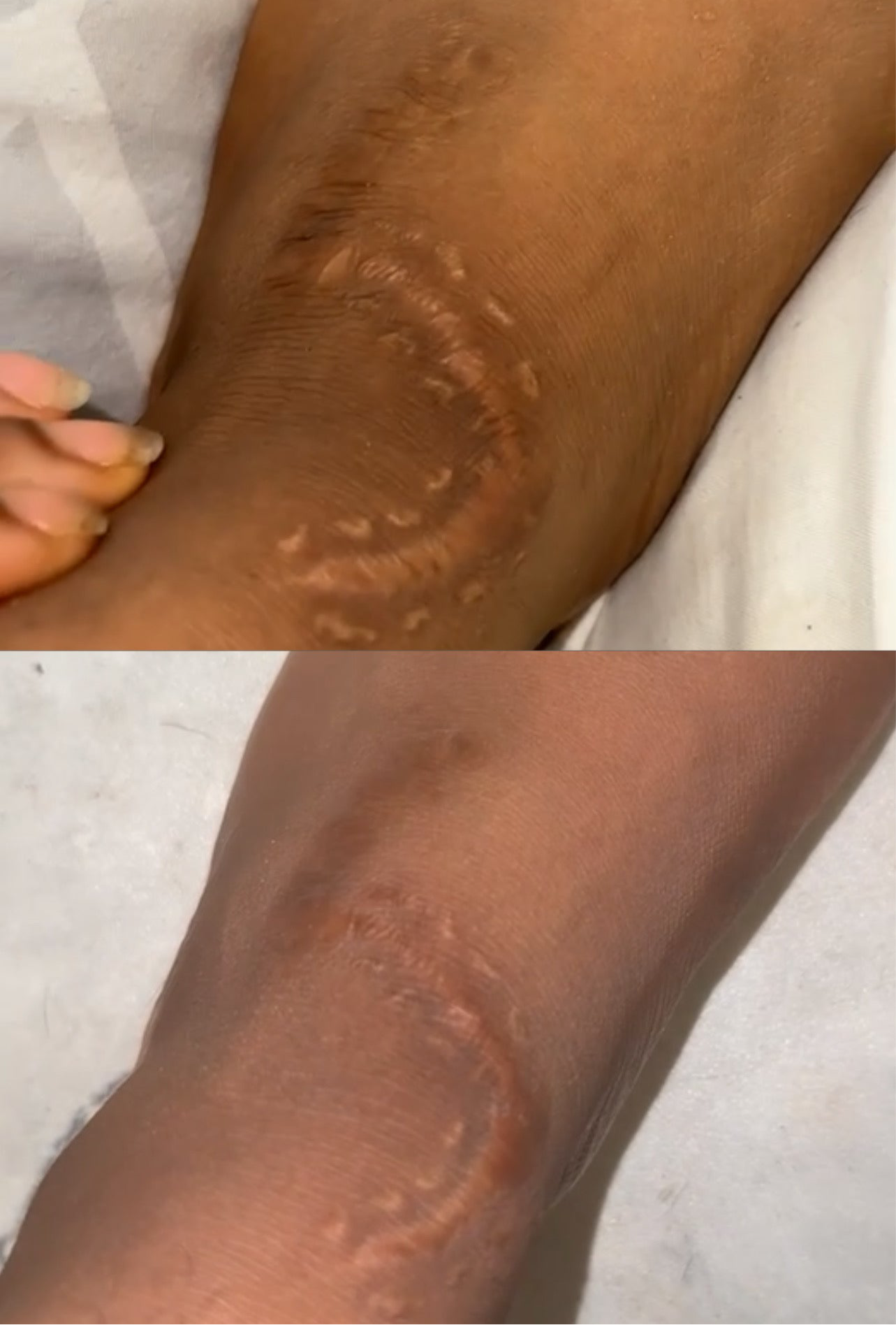 Healing balm - COMING SOON!